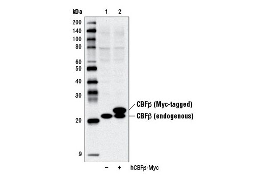 Western Blotting Image 2: CBFβ Antibody