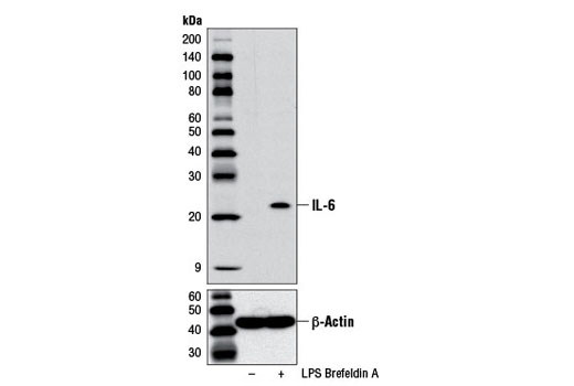 Western Blotting Image 1: IL-6 (D5W4V) XP® Rabbit mAb (Mouse Specific)