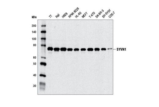 Western Blotting Image 1: SYVN1 Antibody
