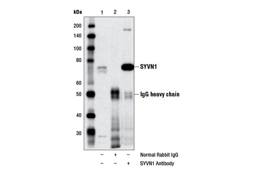 Immunoprecipitation Image 1: SYVN1 Antibody