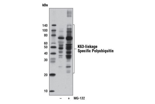 Western Blotting Image 1: K63-linkage Specific Polyubiquitin (D7A11) Rabbit mAb (HRP Conjugate)