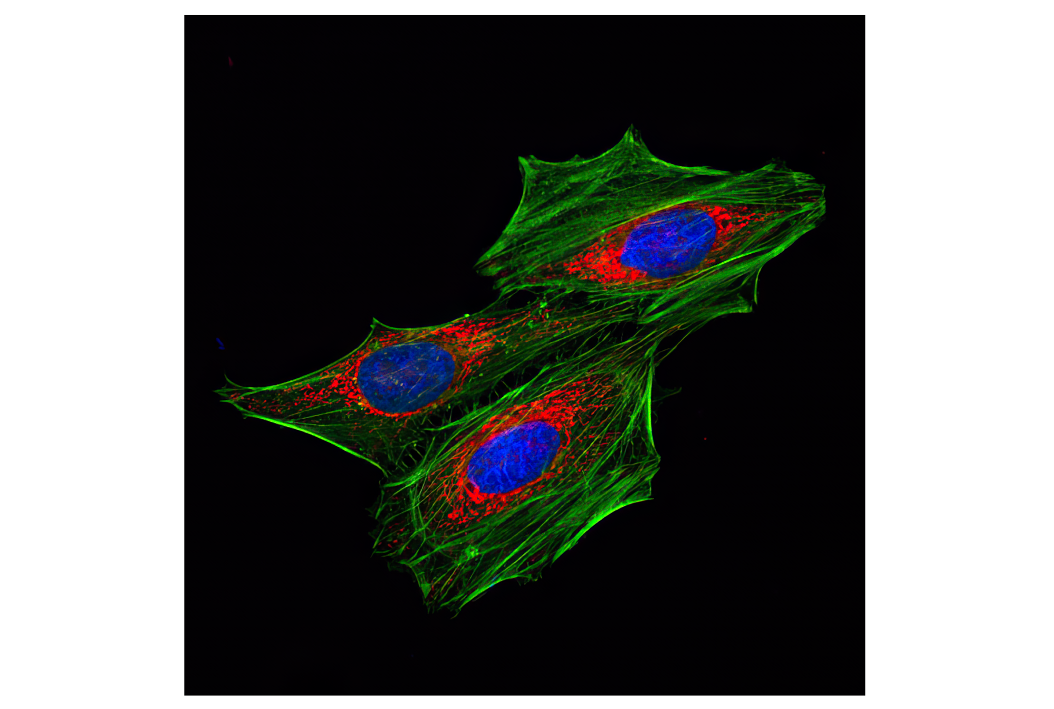 Immunofluorescence Image 2: DyLight 488 Phalloidin