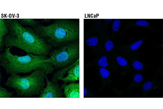 Immunofluorescence Image 1: Galectin-1/LGALS1 (D608T) Rabbit mAb