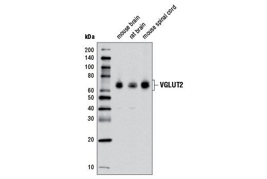 Western Blotting Image 1: VGLUT2 Antibody