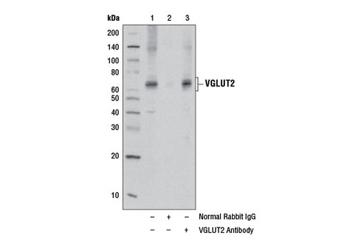 Immunoprecipitation Image 1: VGLUT2 Antibody