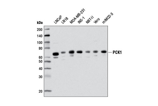  Image 14: Gluconeogenesis Antibody Sampler Kit