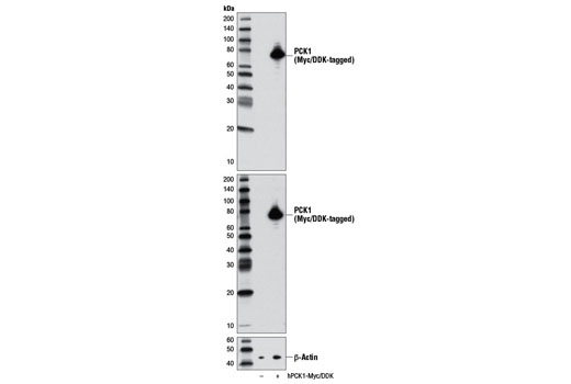  Image 22: Gluconeogenesis Antibody Sampler Kit