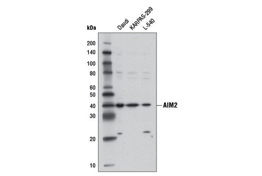  Image 3: Human Reactive Inflammasome Antibody Sampler Kit II