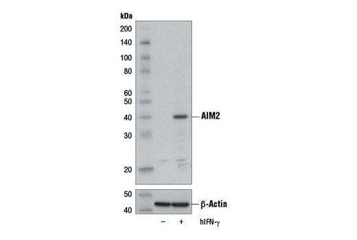  Image 12: Human Reactive Inflammasome Antibody Sampler Kit II