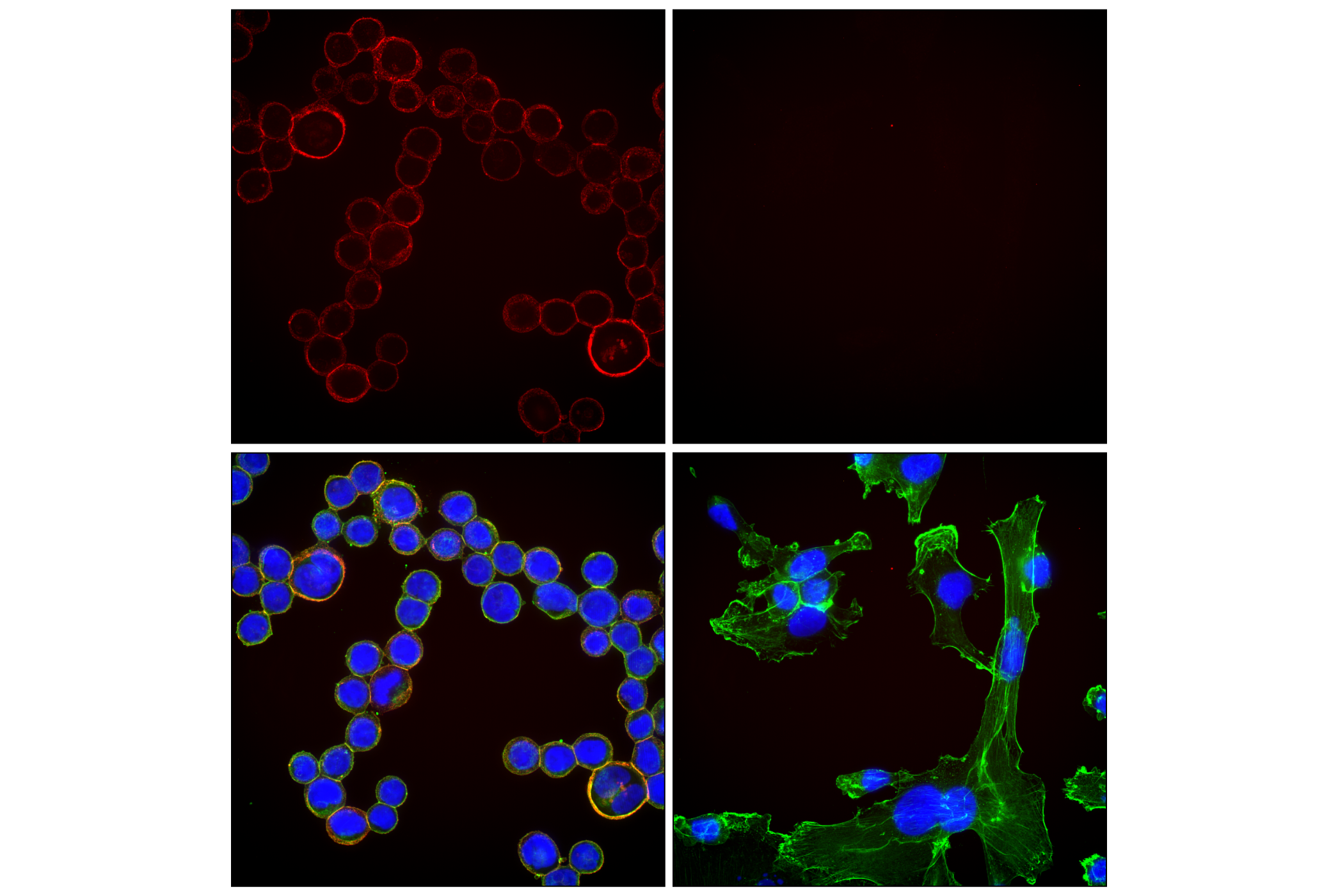 Immunofluorescence Image 1: HER2/ErbB2 (29D8) Rabbit mAb (Alexa Fluor® 647 Conjugate)