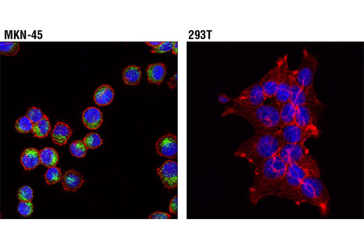 Immunofluorescence Image 1: RAIG1 (D4S7D) XP® Rabbit mAb