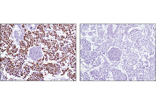 Immunohistochemistry Image 2: MCM4 (D3H6N) XP® Rabbit mAb