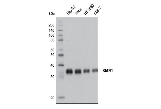 Western Blotting Image 1: SMN1 (2F1) Mouse mAb