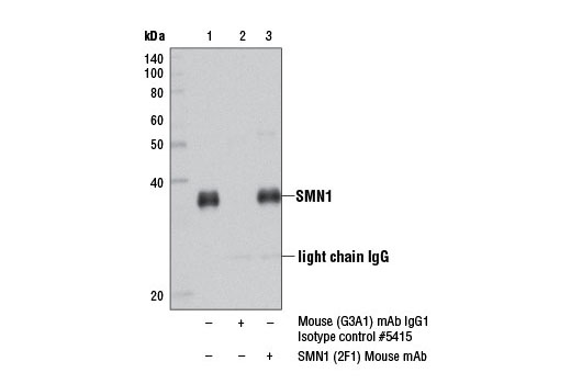 Immunoprecipitation Image 1: SMN1 (2F1) Mouse mAb