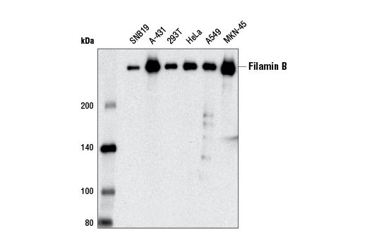 Western Blotting Image 1: Filamin B (D7E4W) Rabbit mAb