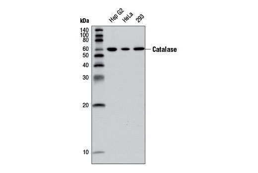 Western Blotting Image 1: Catalase (D4P7B) XP® Rabbit mAb
