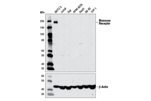 Western Blotting Image 1: Mannose Receptor Antibody
