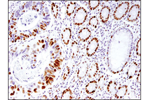 Immunohistochemistry Image 1: MSH6 (3E1) Mouse mAb