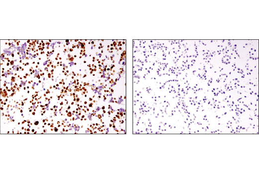 Immunohistochemistry Image 3: MSH6 (3E1) Mouse mAb