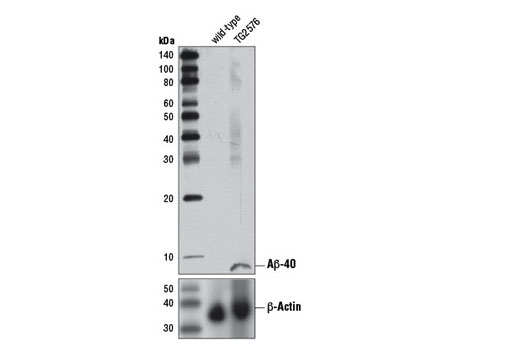 Western Blotting Image 1: β-Amyloid (1-40) (D8Q7I) Rabbit mAb