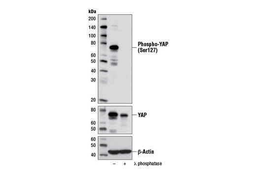 Image 10: Phospho-YAP/TAZ Antibody Sampler Kit