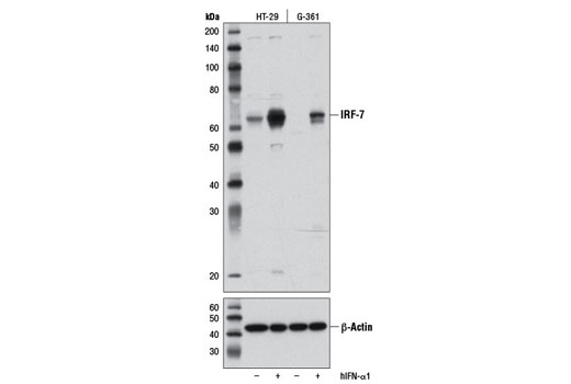  Image 6: Type I Interferon Induction and Signaling Antibody Sampler Kit