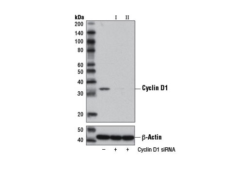  Image 1: SignalSilence® Cyclin D1 siRNA II