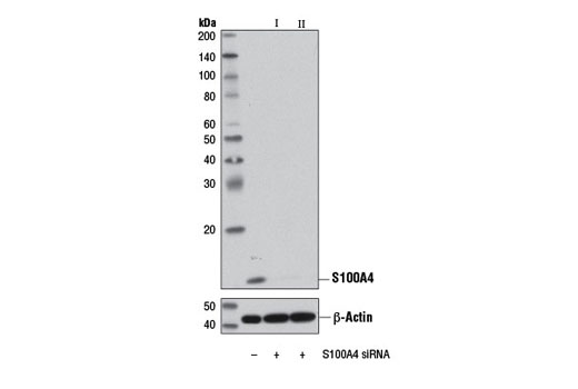  Image 1: SignalSilence® S100A4 siRNA II
