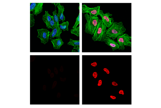 Immunofluorescence Image 1: Acetyl-Histone H3 (Lys27) (D5E4) XP® Rabbit mAb (Alexa Fluor® 555 Conjugate)