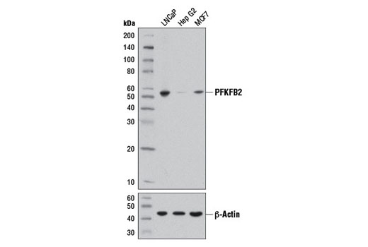  Image 1: PhosphoPlus® PFKFB2 (Ser483) Antibody Duet
