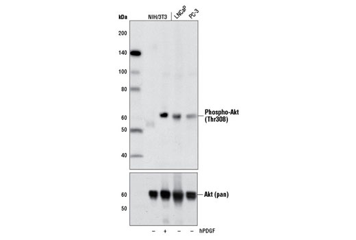  Image 1: AS160 Signaling Antibody Sampler Kit