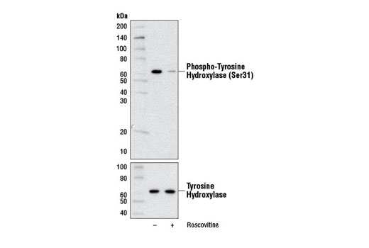Western Blotting Image 1: Phospho-Tyrosine Hydroxylase (Ser31) (D6I9V) Rabbit mAb