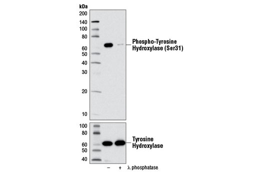 Western Blotting Image 2: Phospho-Tyrosine Hydroxylase (Ser31) (D6I9V) Rabbit mAb