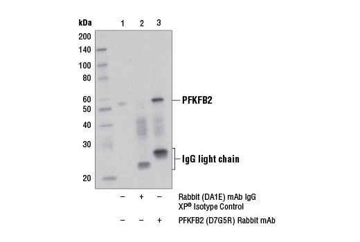 Immunoprecipitation Image 1: PFKFB2 (D7G5R) Rabbit mAb