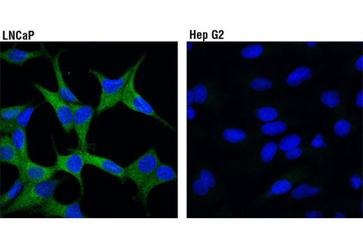 Immunofluorescence Image 1: PFKFB2 (D7G5R) Rabbit mAb