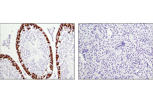 Immunohistochemistry Image 1: DAZL (D2A4) Rabbit mAb (IHC Specific)