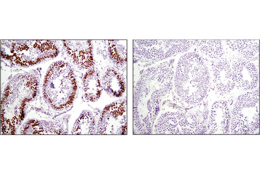 Immunohistochemistry Image 2: DAZL (D2A4) Rabbit mAb (IHC Specific)