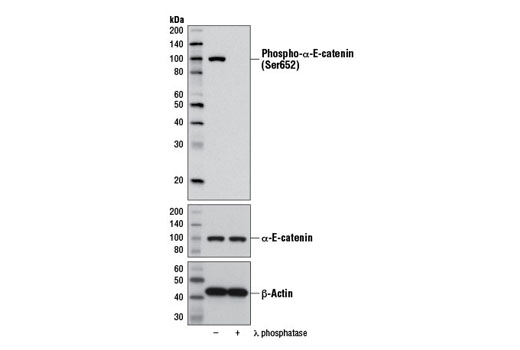 Western Blotting Image 2: Phospho-α-E-Catenin (Ser652) Antibody