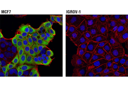 Immunofluorescence Image 1: AGR2 (D9V2F) XP® Rabbit mAb