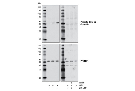  Image 2: PhosphoPlus® PFKFB2 (Ser483) Antibody Duet
