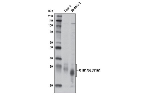 Western Blotting Image 1: CTR1/SLC31A1 Antibody