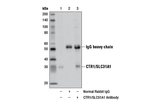 Immunoprecipitation Image 1: CTR1/SLC31A1 Antibody