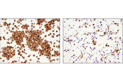 Immunohistochemistry Image 2: eIF4B (1F5) Mouse mAb