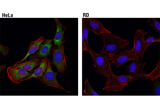 Immunofluorescence Image 1: eIF4B (1F5) Mouse mAb