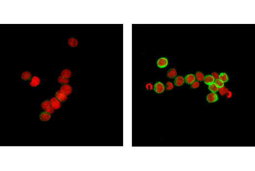 Immunofluorescence Image 1: Phospho-HS1 (Tyr397) (D12C1) XP® Rabbit mAb (Alexa Fluor® 488 Conjugate)