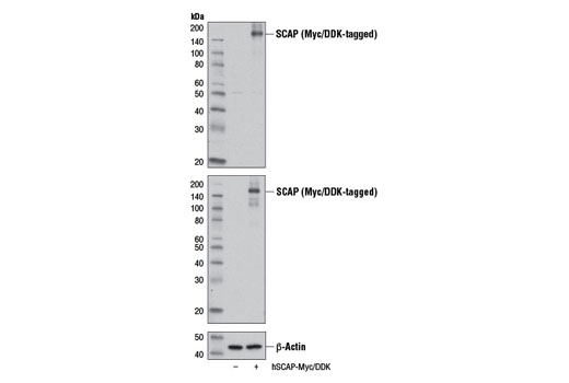 Western Blotting Image 2: SCAP Antibody