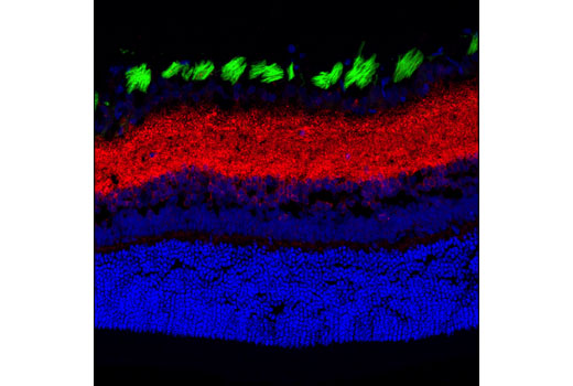 Immunofluorescence Image 1: Synapsin-1 (D12G5) XP® Rabbit mAb (Alexa Fluor® 555 Conjugate)