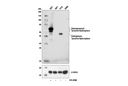 Western Blotting Image 1: Tyrosine Hydroxylase (A8Y7R) Rabbit mAb