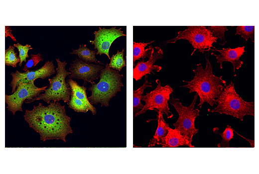 Immunofluorescence Image 2: Tyrosine Hydroxylase (A8Y7R) Rabbit mAb