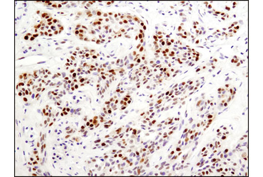 Immunohistochemistry Image 1: PCNA (D3H8P) XP® Rabbit mAb 